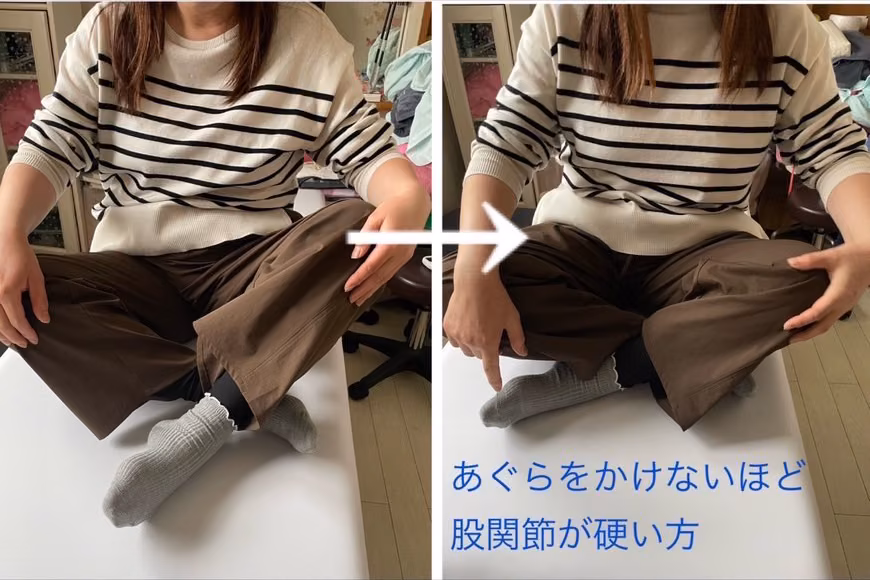 あぐらがかけないほど硬かった股関節の可動域改善 ビフォーアフター