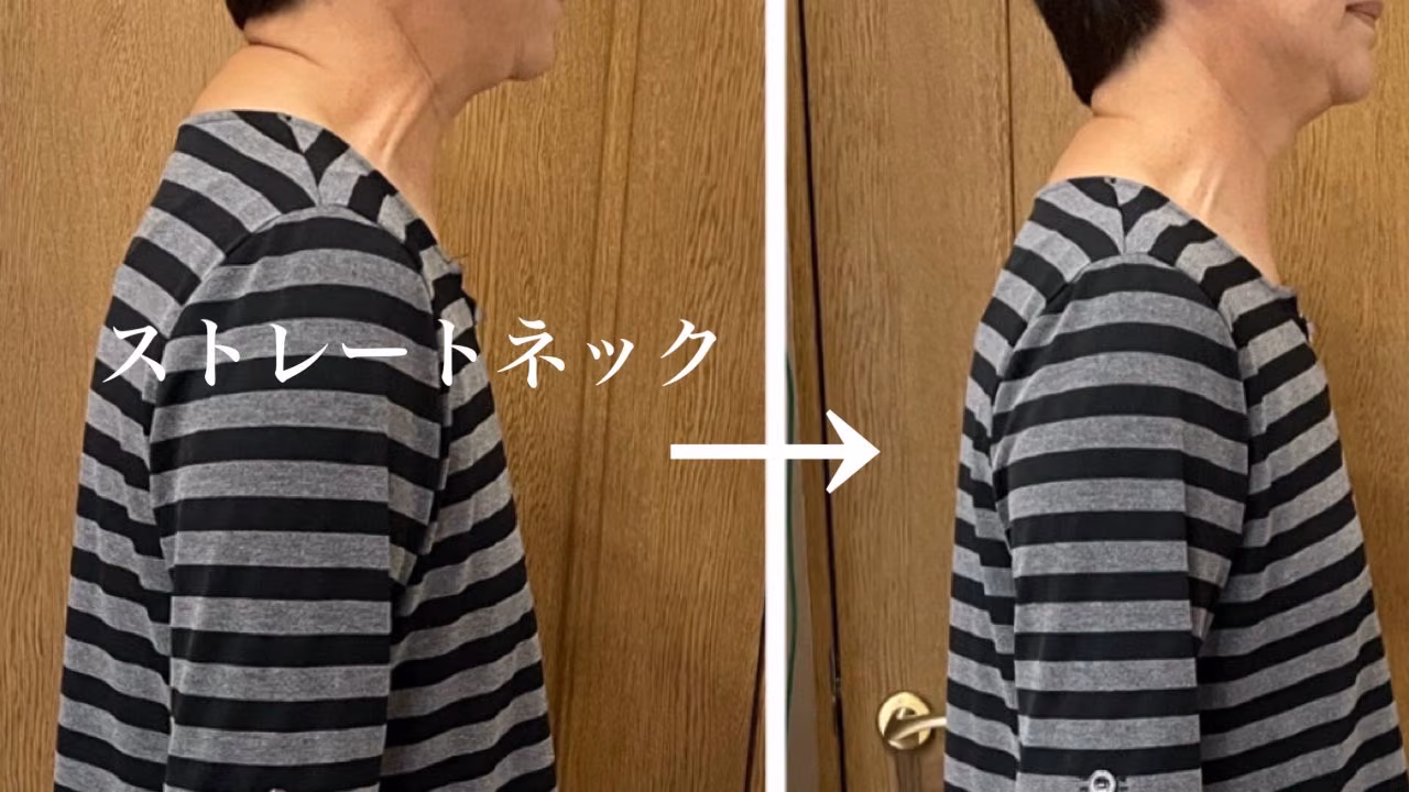 ストレートネックの改善 ビフォーアフター